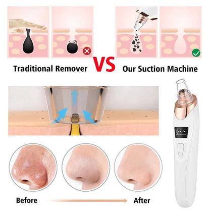 Electric Blackhead Remover Vacuum – Professional Pore Cleaner & Acne Needle Kit